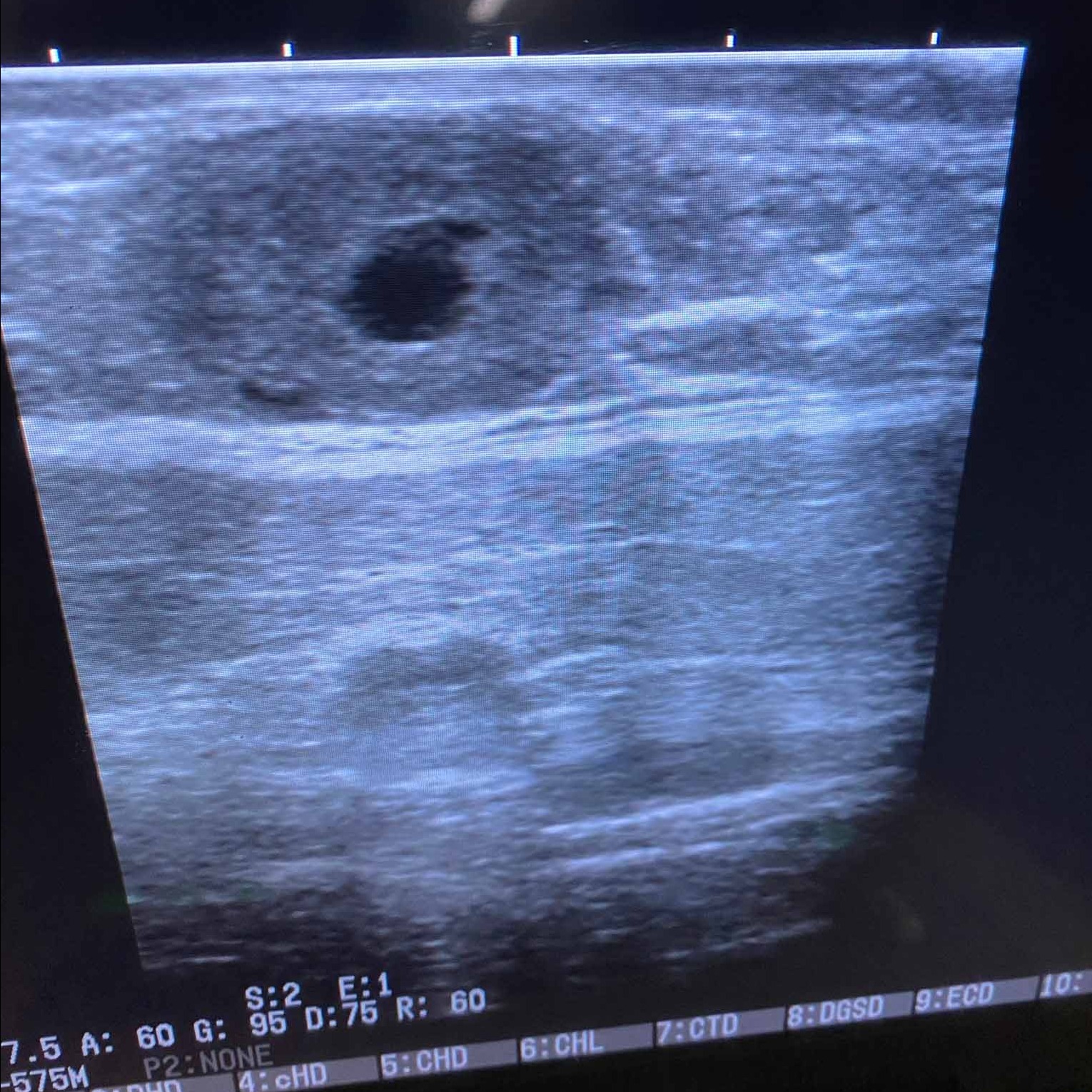 Ultrasound image of a female heifer's ovaries
