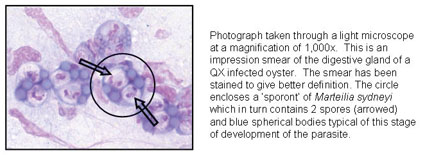 Individual spores of QX disease