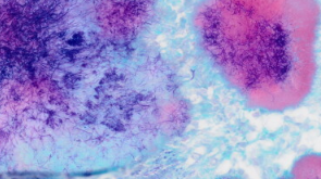 Gram positive stain example