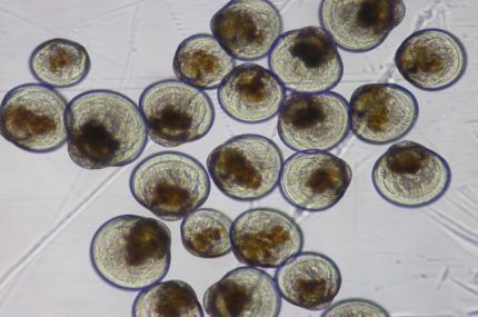 Larvae under a microscope